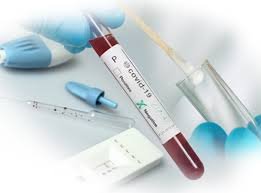 ANS inclui mais seis exames no Rol para auxiliar no diagnóstico e tratamento do novo Coronavírus